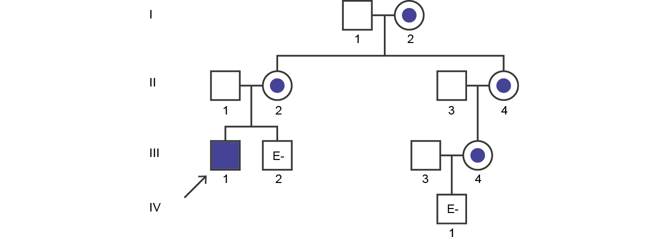 Fabry disease pedigree analysis case study 3